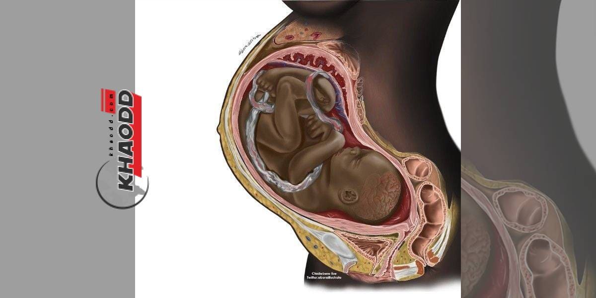 ภาพทารกผิวดำในครรภ์ เป็นกระแสในวงการแพทย์งหนักมาก!!