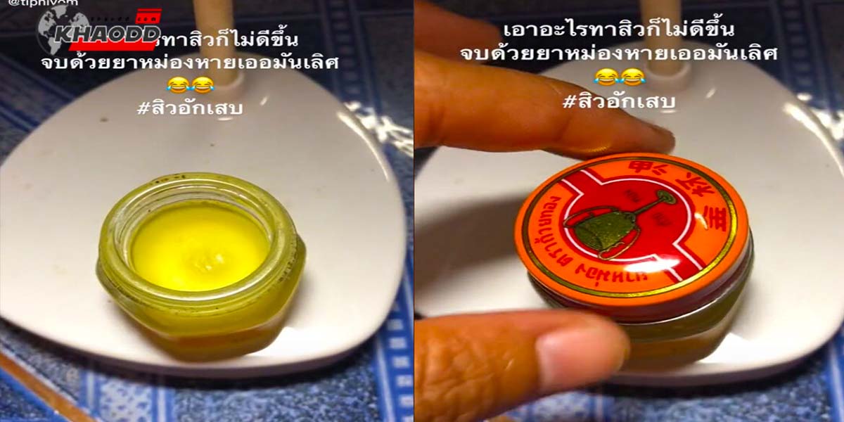 ชาวเน็ตสงสัย ใช้ยาหม่องทาสิวได้หรอ