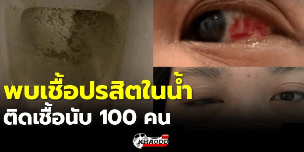 พบ ติดเชื้อปรสิตในน้ำ