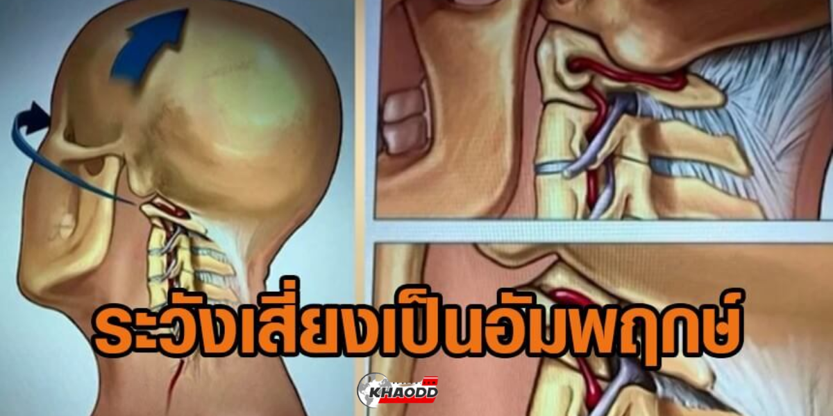 คอ_ เป็นตำแหน่งอันตราย มีเส้นเลือดสำคัญอยู่