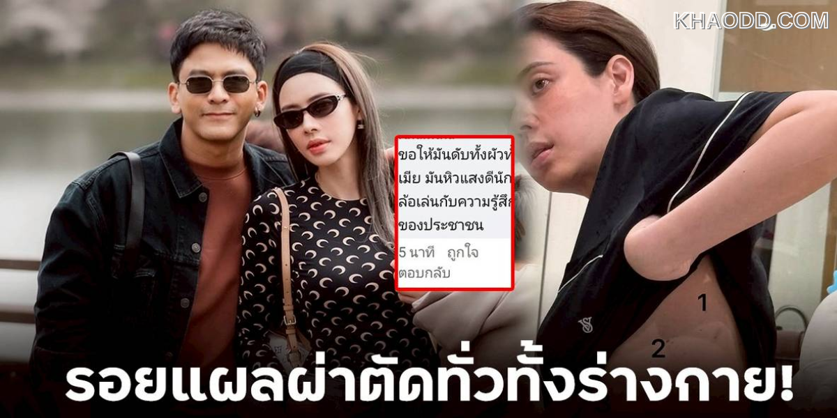 เอ๋ พรทิพย์_ 1 เดือน รอยแผลทั้งตัว _ป๋อ (2)
