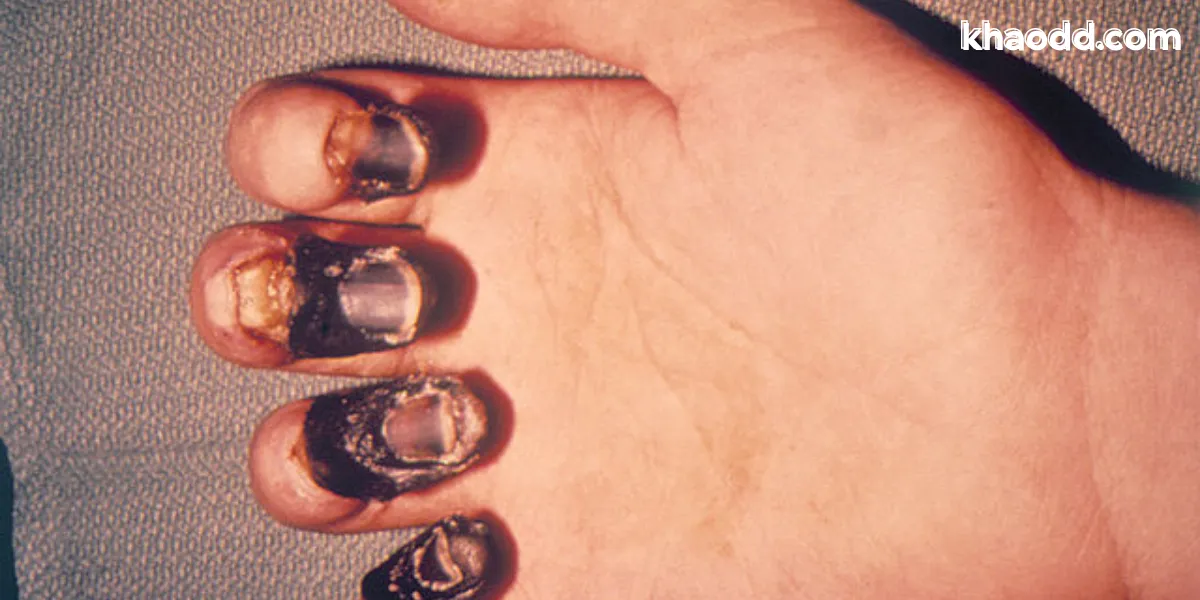 กำเนิดกาฬโรค The Black Death