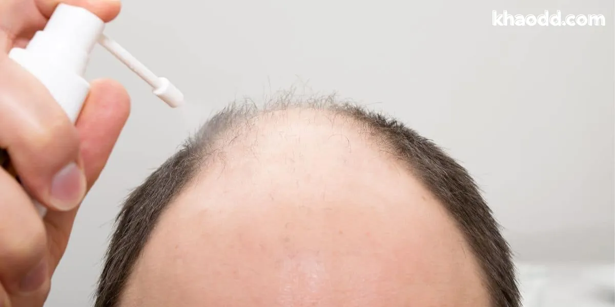 ฝันว่าหัวล้าน