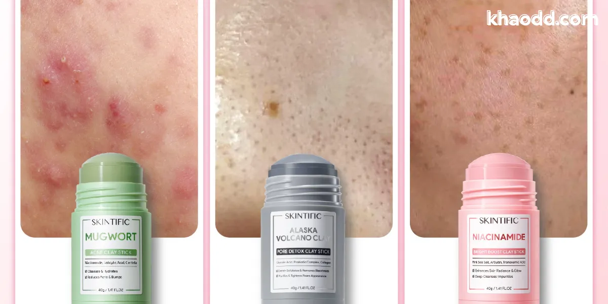 Skintific มาร์คโคลน รีวิวเต็ม ลดสิวอุดตัน คุมมัน กระชับรูขุมขน